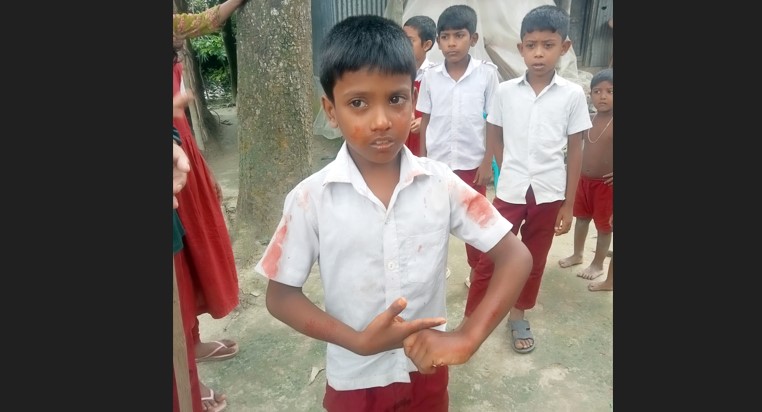 তুচ্ছ ঘটনায় শিশু শিক্ষার্থীর নাক ফাটালেন সহকারি শিক্ষক! 