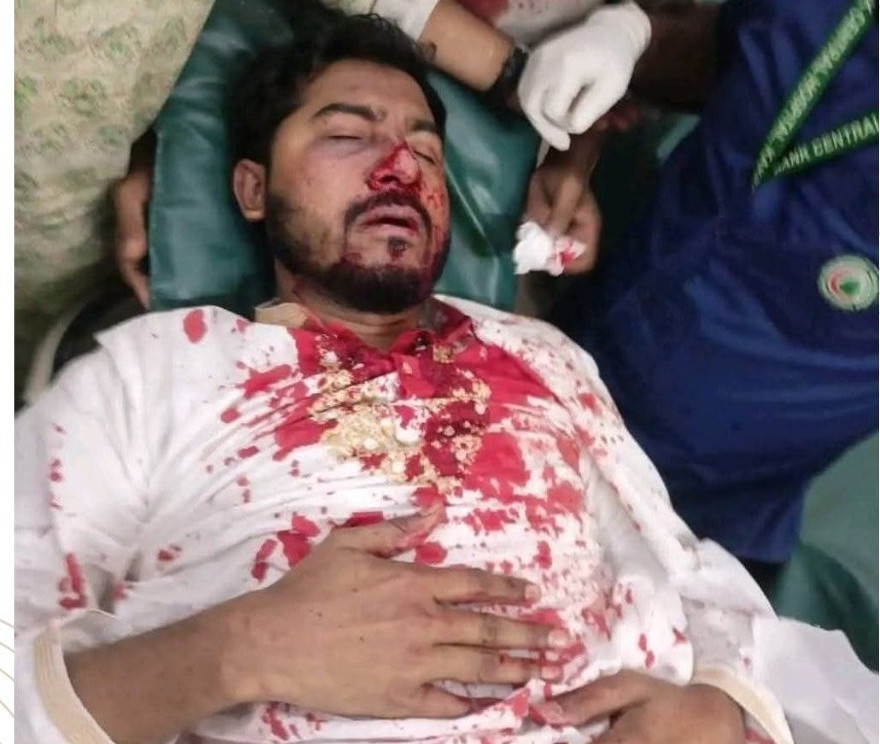 কাকরাইলে সংঘর্ষে রক্তাক্ত নুর, উত্তপ্ত রাজনীতি: এনসিপির বিক্ষোভ কর্মসূচির ঘোষণা