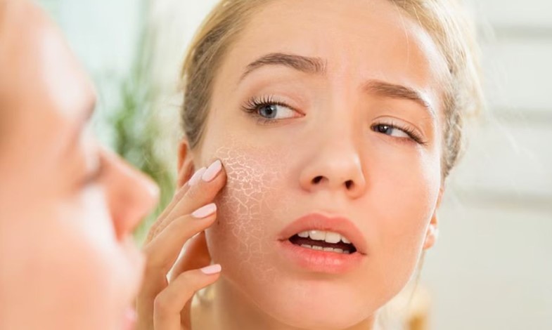 শীতের আগেই ত্বক খসখসে: কীভাবে যত্ন নেবেন, জেনে নিন সহজ উপায়