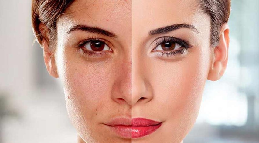 ত্বকের যত্ন মানে দামি ক্রিম নয়,আপনার দৈনন্দিন যে ৬টি ভুল ত্বককে ক্ষতি করছে