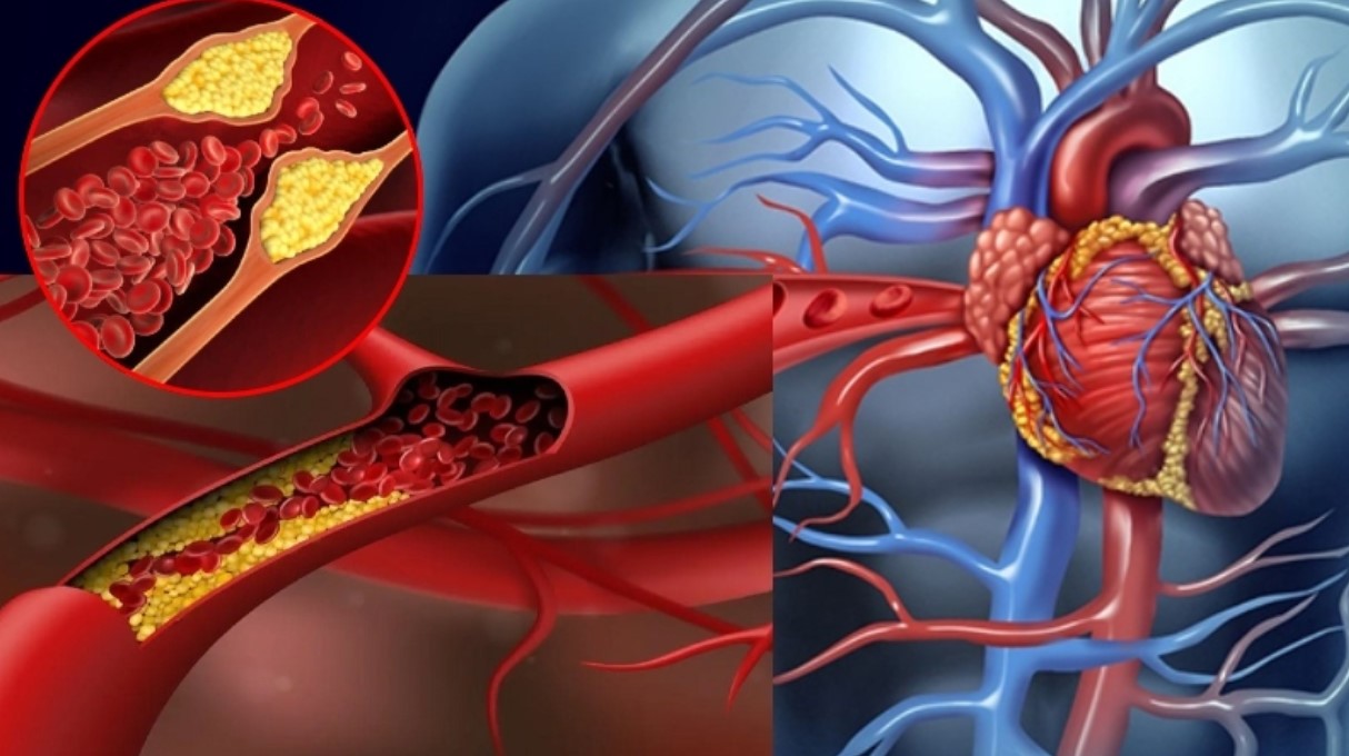 হৃদরোগের ঝুঁকি কম বয়সে: হার্টের রক্তনালী বন্ধ হওয়ার ৭টি প্রাথমিক লক্ষণ চিনে সতর্ক হোন