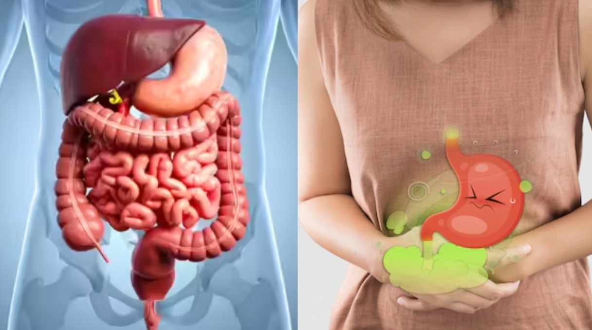 পেট ফাঁপা ও গ্যাসে ভুগছেন? মাত্র ১১ দিনেই স্বস্তি মেলার উপায়