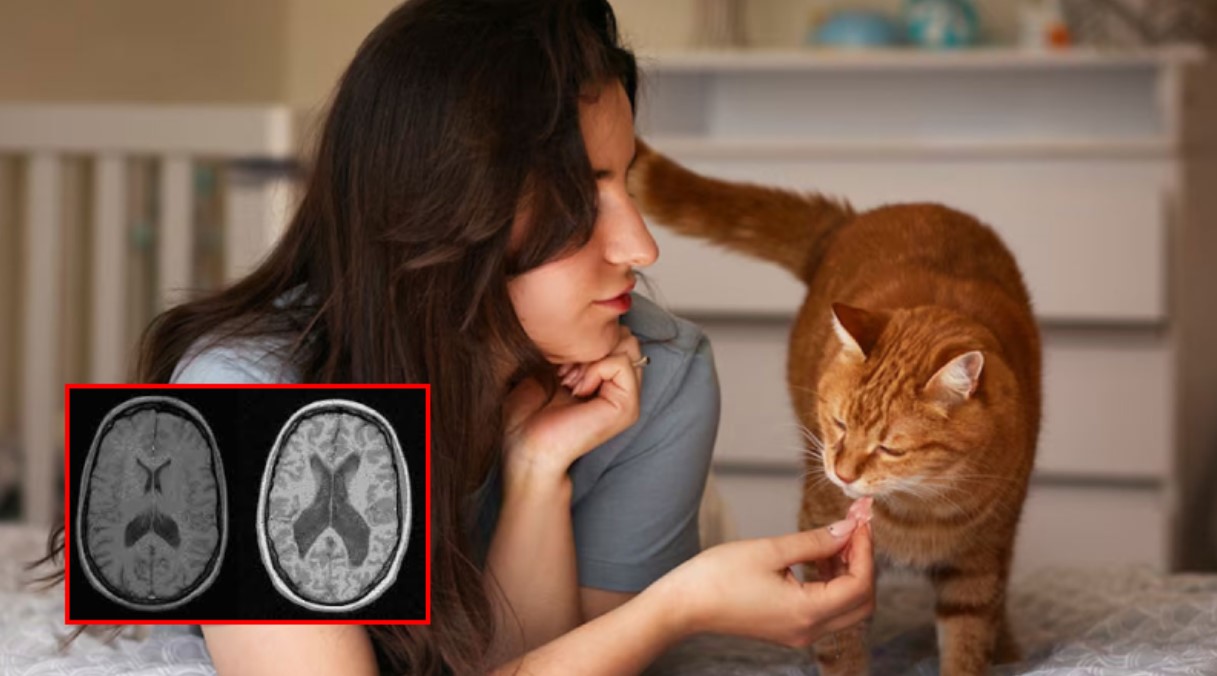 বিড়াল পালনের সঙ্গে মানসিক রোগের ঝুঁকি, আন্তর্জাতিক গবেষণায় নতুন ইঙ্গিত