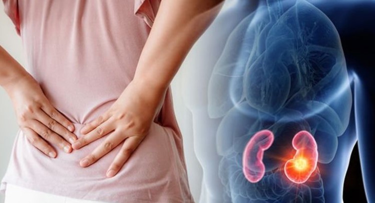 চোখের যে ৫ লক্ষণে বুঝবেন কিডনি নষ্ট হচ্ছে