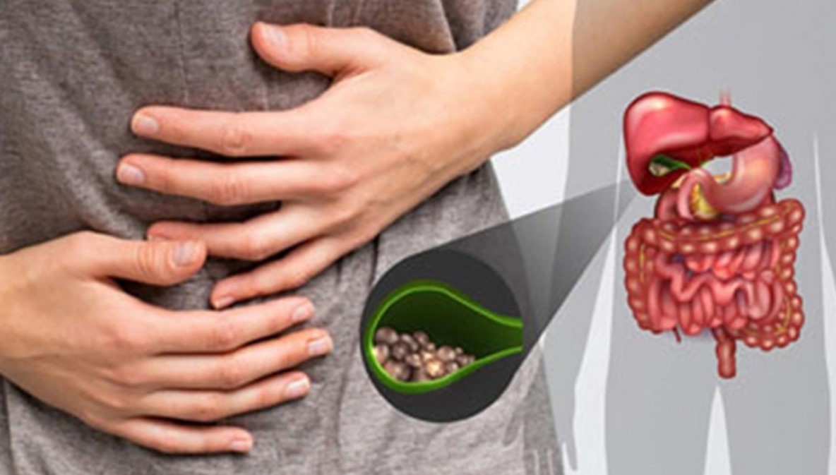 অজান্তেই পিত্তথলিতে পাথর জমাচ্ছে আপনার এই ৫টি ভুল অভ্যাস