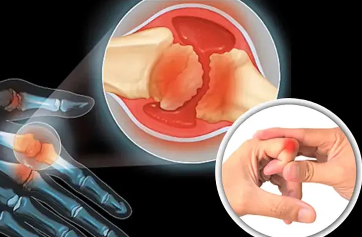 আঙুল ফোটানোর শব্দ নিয়ে কয়েক দশকের ভুল ভাঙল আধুনিক গবেষণায়