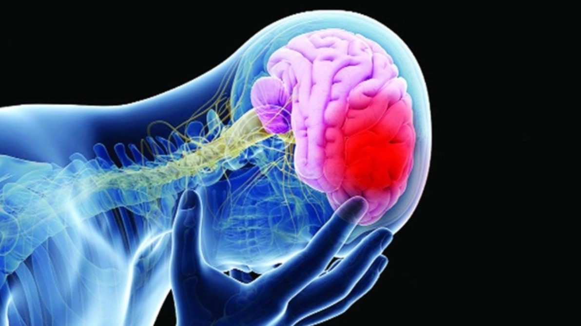 স্ট্রোক হওয়ার কয়েক দিন আগেই পাওয়া যায় সিগন্যাল: ৫টি লক্ষণ চিনুন