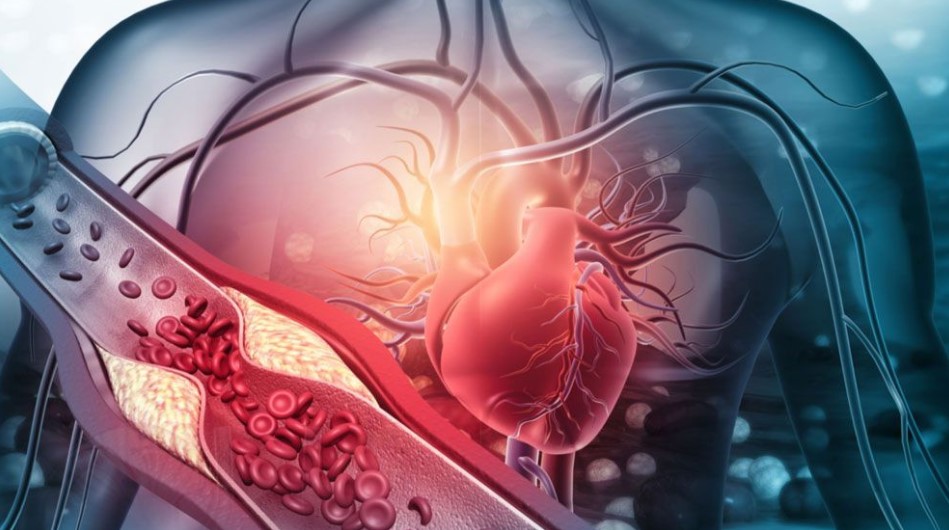 হৃদরোগ ও স্ট্রোকের ঝুঁকি কমাতে কোলেস্টেরল বশে রাখুন: বিশেষজ্ঞ টিপস