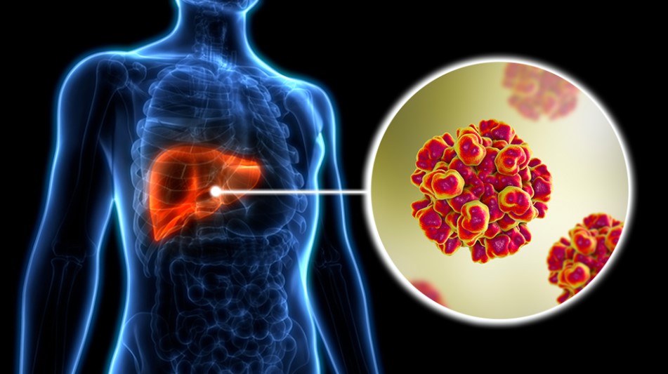 হেপাটাইটিস ‘ই’ চিকিৎসায় যুগান্তকারী আবিষ্কার: লাখো প্রাণ বাঁচাতে নতুন আশার আলো