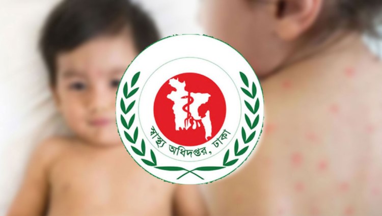 হামের উপসর্গে একদিনে ১১ জনের মৃত্যু, আক্রান্ত আরও শতাধিক শিশু