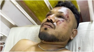২৪১ নিহত, অলৌকিকভাবে বেঁচে গেলেন একজন