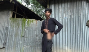 মহসিনের যন্ত্রণার গল্প: গুলিবিদ্ধ, স্বীকৃতি নেই, সহায়তাও মেলেনি