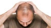 অকালেই কি ফাঁকা হচ্ছে মাথা? জেনে নিন চুল পড়া রোধের অব্যর্থ কৌশল